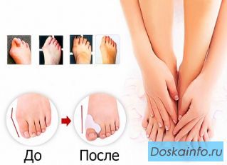Защита больших пальцев ног Valgus Pro 2 шт.