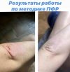Уменьшенная картинка