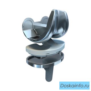 Эндопротез коленного сустава